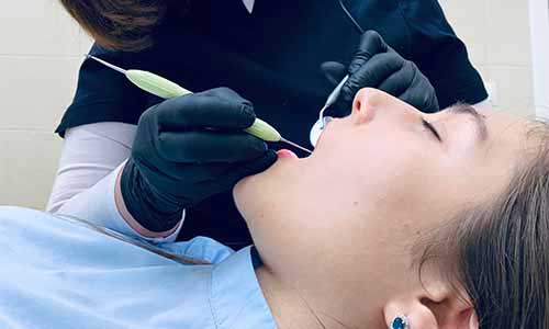Cosmetic Dentistry / Smile Makeover